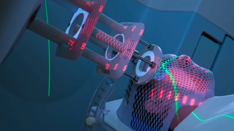 La Argentina será pionera en América Latina para tratar el cáncer con protones