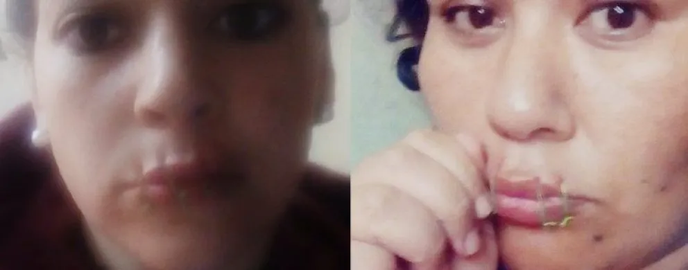 ¡Increíble! Dos presas se cosieron la boca para pedir su traslado a Viedma