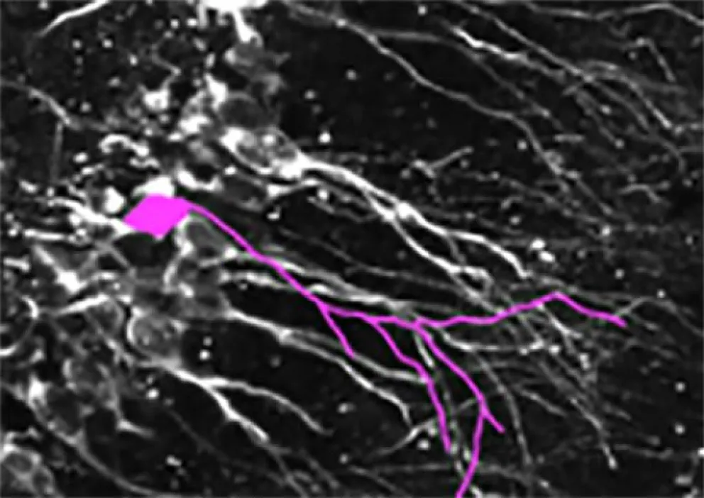 Identifican una proteína que podría ser clave para pacientes con enfermedades neurodegenerativas