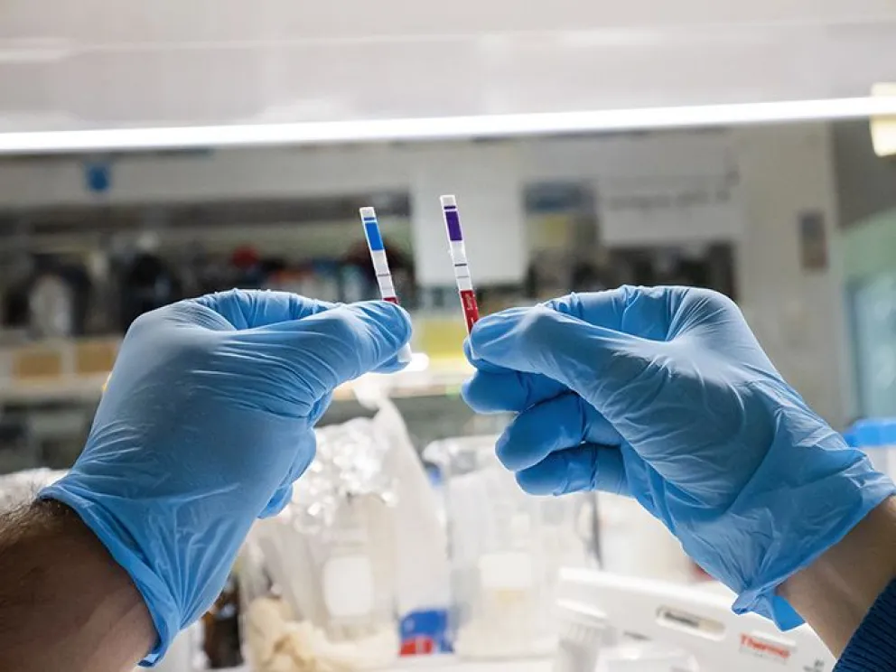 COVID-19: hacia el primer test de antígenos 100% argentino