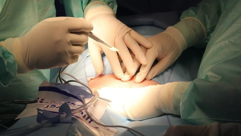 Por error de diagnóstico le extirparon una mama: la doctora fue sobreseída