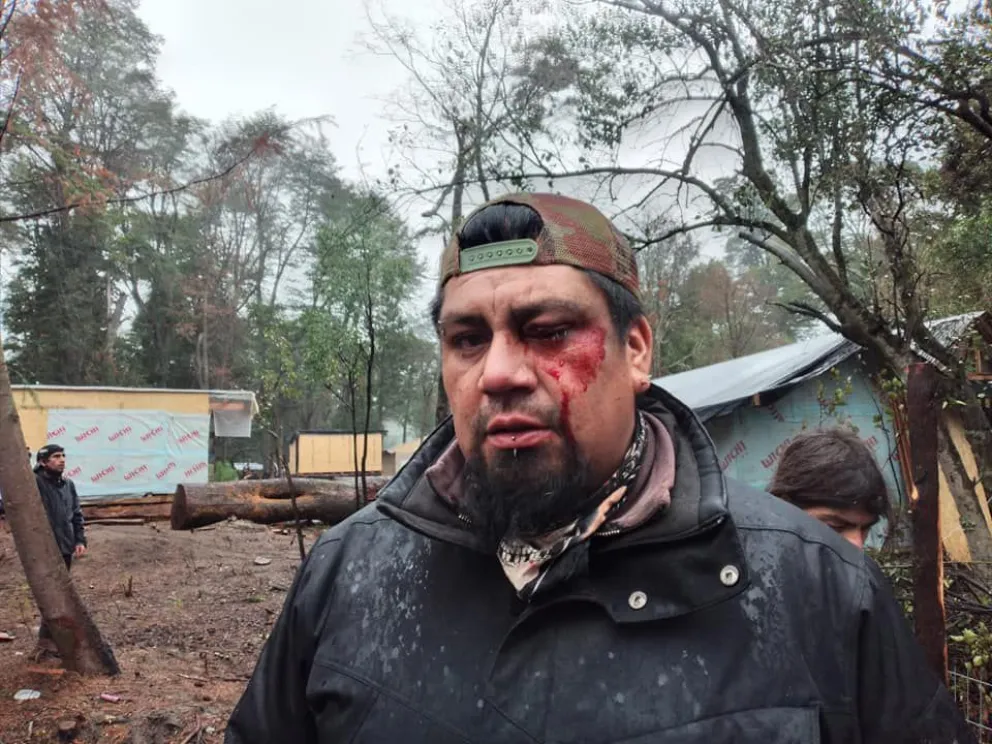 Violento enfrentamiento entre ocupantes de una toma en Villa La Angostura y el grupo GEOP