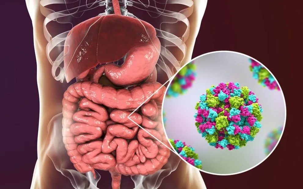 Especialistas alertan sobre el virus de los vómitos de invierno: de qué se trata
