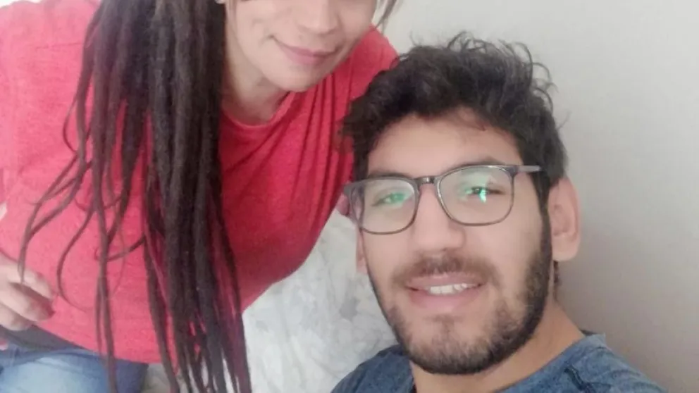 Las impresionantes secuelas del Covid que le quedaron a un joven de 20 años 